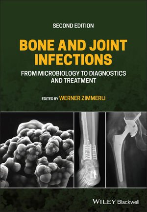 کتاب 2021&nbsp;Back to results Bone and Joint Infections: From Microbiology to Diagnostics and Treatment 2nd