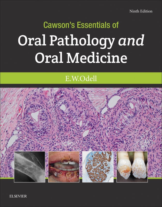 کتاب اورال پاتولوژی اند اورال مدیسین Cawson's  Essentials of Oral Pathology and Oral Medicine 2017 9th