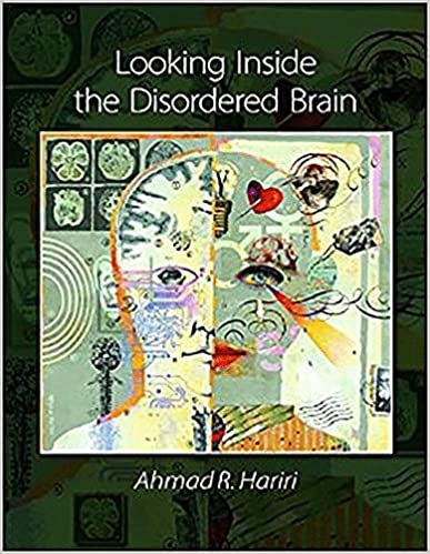 کتاب لوکینگ اینساید د دیس اردرد برین Looking Inside the Disordered Brain
