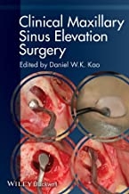 کتاب کلینیکال مکسیلیری سینوس الویشن سرجری Clinical Maxillary Sinus Elevation Surgery 1st Edition2014