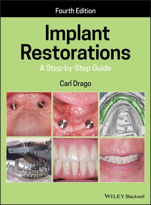 کتاب ایمپلنت رستوریشنز Implant Restorations: A Step-by-Step Guide 4th Edition, Kindle Edition 2020